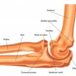 bone-fractures-in-the-elbow-300x225